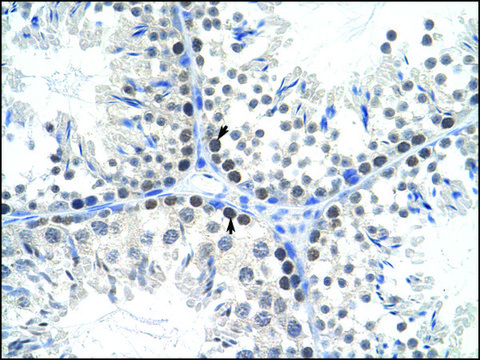 Anti-TFAM (AB3) antibody produced in rabbit affinity isolated antibody