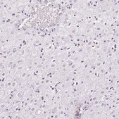 Anti-LVRN antibody produced in rabbit Prestige Antibodies® Powered by Atlas Antibodies, affinity isolated antibody, buffered aqueous glycerol solution