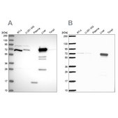 Anti-PCK2 antibody produced in rabbit Prestige Antibodies® Powered by Atlas Antibodies, affinity isolated antibody, buffered aqueous glycerol solution