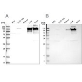 Anti-COL6A2 antibody produced in rabbit Prestige Antibodies® Powered by Atlas Antibodies, affinity isolated antibody