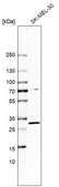Anti-TP53RK antibody produced in rabbit Prestige Antibodies® Powered by Atlas Antibodies, affinity isolated antibody, buffered aqueous glycerol solution