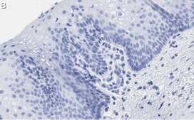 Anti-TLE3 Antibody, clone 1D15 ZooMAb® Rabbit Monoclonal recombinant, expressed in HEK 293 cells