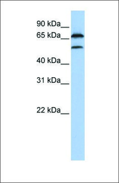 Anti-FBXO7 antibody produced in rabbit affinity isolated antibody