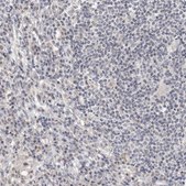 Anti-CGN antibody produced in rabbit Prestige Antibodies® Powered by Atlas Antibodies, affinity isolated antibody, buffered aqueous glycerol solution, ab2