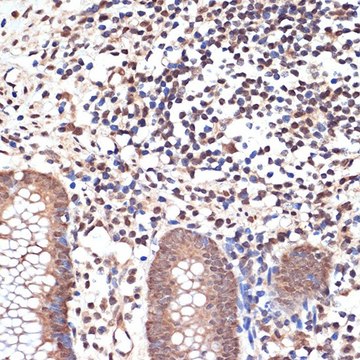 Anti-KAT8/MYST1/MOF antibody produced in rabbit