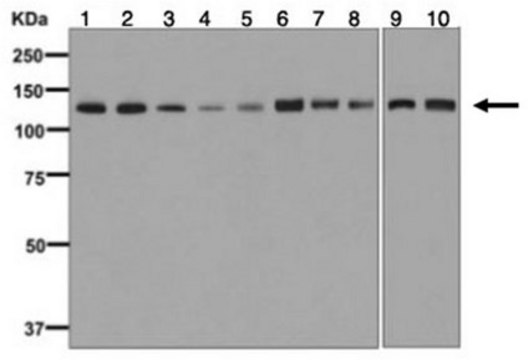 Anti-UBE4B, clone EPR7471, Rabbit Monoclonal Antibody clone EPR7471, from rabbit