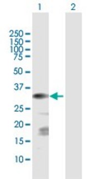 Anti-CSGALNACT1 antibody produced in rabbit purified immunoglobulin, buffered aqueous solution