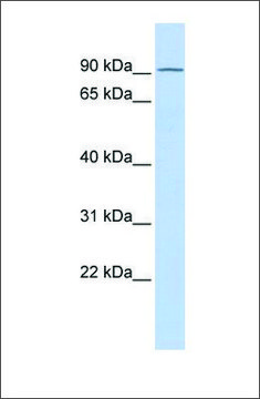 Anti-TIPARP antibody produced in rabbit affinity isolated antibody