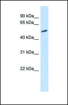 Anti-IKZF2 antibody produced in rabbit affinity isolated antibody