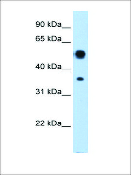 Anti-ASL (AB1) antibody produced in rabbit affinity isolated antibody