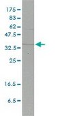 Monoclonal Anti-FHL2 antibody produced in mouse clone 2G3-1A5, purified immunoglobulin, buffered aqueous solution