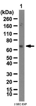 抗-IGF2 mRNA-结合蛋白3抗体 from rabbit, purified by affinity chromatography