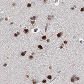 Anti-SCAF8 antibody produced in rabbit Prestige Antibodies® Powered by Atlas Antibodies, affinity isolated antibody, buffered aqueous glycerol solution