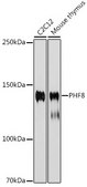 Anti-PHF8 Antibody, clone 2H9D4, Rabbit Monoclonal