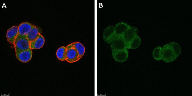 Anti-Estradiol (6-BSA) Antibody purified antibody, clone 6E1, from mouse