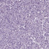 Anti-CD109 antibody produced in rabbit Prestige Antibodies® Powered by Atlas Antibodies, affinity isolated antibody