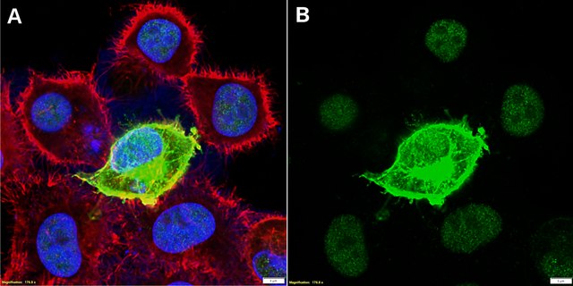 Anti-His tag Antibody, clone 1J13 ZooMAb&#174; Rabbit Monoclonal recombinant, expressed in HEK 293 cells