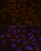 Anti-UBE2C Antibody, clone 5G5L9, Rabbit Monoclonal
