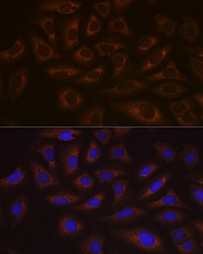 Anti-UBE2C Antibody, clone 5G5L9, Rabbit Monoclonal