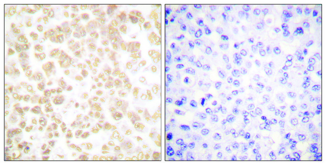 Anti-FRA-2 antibody produced in rabbit affinity isolated antibody