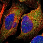 Anti-TSPAN6 antibody produced in rabbit Prestige Antibodies® Powered by Atlas Antibodies, affinity isolated antibody, buffered aqueous glycerol solution
