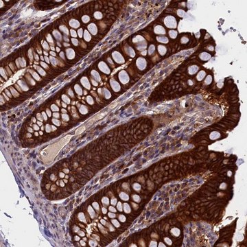 Anti-DENND1B antibody produced in rabbit Prestige Antibodies&#174; Powered by Atlas Antibodies, affinity isolated antibody, buffered aqueous glycerol solution