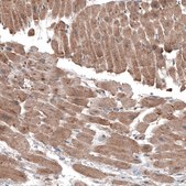 Monoclonal Anti-LAPTM4B antibody produced in mouse Prestige Antibodies® Powered by Atlas Antibodies, clone CL5287, purified immunoglobulin, buffered aqueous glycerol solution