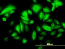 Monoclonal Anti-KRT17 antibody produced in mouse clone 2D4-1G9, purified immunoglobulin, buffered aqueous solution