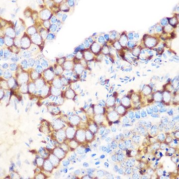 Anti-RUVBL1/TIP49A/PONTIN antibody produced in rabbit