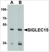 抗 SIGLEC15 兔抗 affinity isolated antibody