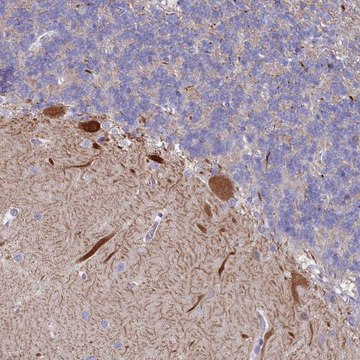 Anti-WDR76 antibody produced in rabbit Prestige Antibodies&#174; Powered by Atlas Antibodies, affinity isolated antibody, buffered aqueous glycerol solution