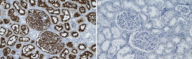 Anti-Neprilysin/CD10 Antibody, clone 1C22 ZooMAb&#174; Rabbit Monoclonal recombinant, expressed in HEK 293 cells