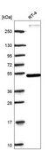 Anti-Rora Antibody Produced In Rabbit Prestige Antibodies® Powered by Atlas Antibodies, affinity isolated antibody, buffered aqueous glycerol solution