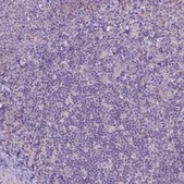 Anti-TM6SF2 antibody produced in rabbit Prestige Antibodies® Powered by Atlas Antibodies, affinity isolated antibody, buffered aqueous glycerol solution