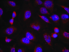 Anti-BCL2 (Ab-70) antibody produced in rabbit affinity isolated antibody
