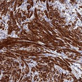 Anti-ZDHHC16 antibody produced in rabbit Prestige Antibodies® Powered by Atlas Antibodies, affinity isolated antibody, buffered aqueous glycerol solution