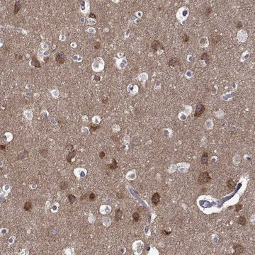 Anti-TARBP2 antibody produced in rabbit Prestige Antibodies&#174; Powered by Atlas Antibodies, affinity isolated antibody, buffered aqueous glycerol solution