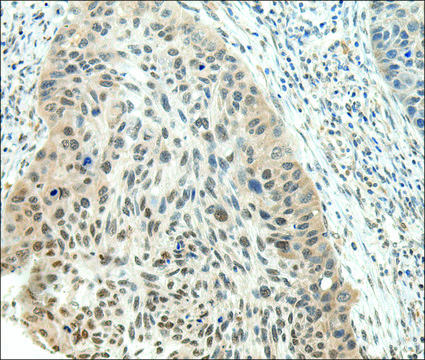 Anti-NSD1 affinity isolated antibody