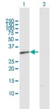 Anti-RDH12 antibody produced in rabbit purified immunoglobulin, buffered aqueous solution