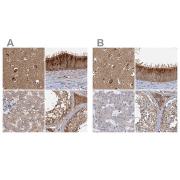 Anti-TOLLIP antibody produced in rabbit Prestige Antibodies&#174; Powered by Atlas Antibodies, affinity isolated antibody, buffered aqueous glycerol solution