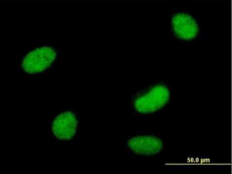 Anti-SMARCAL1 antibody produced in mouse purified immunoglobulin, buffered aqueous solution