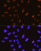 Anti-YAP1 antibody produced in rabbit
