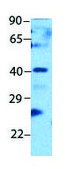 Anti-PAX2 antibody produced in rabbit affinity isolated antibody