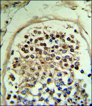 ANTI-HCCA2 (N-TERM) antibody produced in rabbit IgG fraction of antiserum, buffered aqueous solution