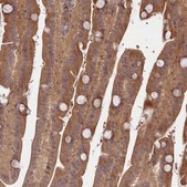 Anti-TBCA antibody produced in rabbit Prestige Antibodies® Powered by Atlas Antibodies, affinity isolated antibody, buffered aqueous glycerol solution