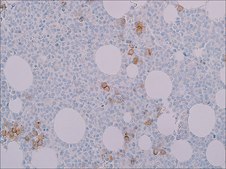 Spectrin (EP251) Rabbit Monoclonal Primary Antibody