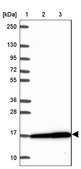 Anti-RPS16 antibody produced in rabbit Prestige Antibodies® Powered by Atlas Antibodies, affinity isolated antibody, buffered aqueous glycerol solution