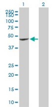 Anti-CXCR6 antibody produced in rabbit purified immunoglobulin, buffered aqueous solution