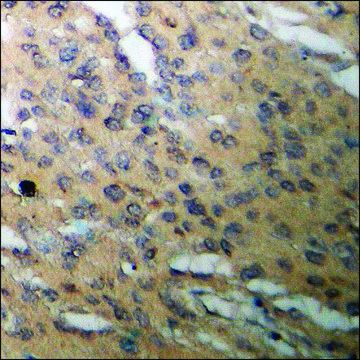 Anti-phospho-CDC6 (pSer54) antibody produced in rabbit affinity isolated antibody