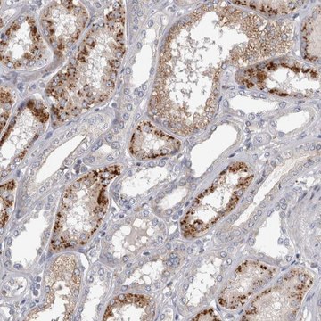 Anti-STRADB antibody produced in rabbit Prestige Antibodies&#174; Powered by Atlas Antibodies, affinity isolated antibody, buffered aqueous glycerol solution